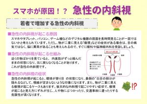 2025.10 内斜視のサムネイル